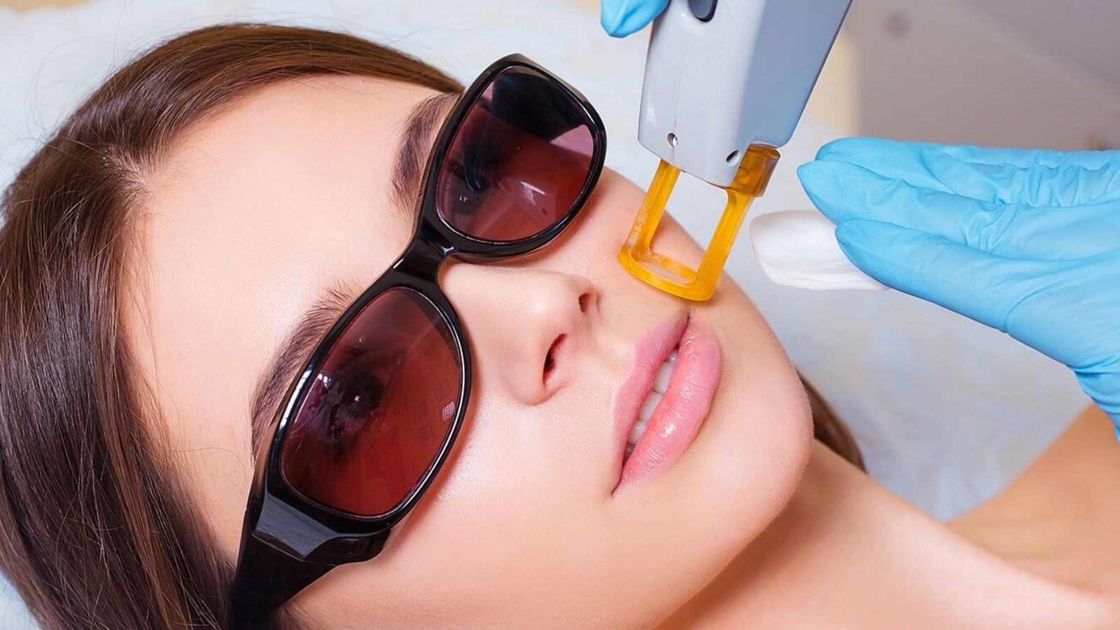 Q Switch tüy sarartma uygulaması