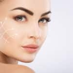 Ameliyatsız Yüz Germe