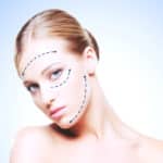 yüz germe - yüz gerdirme