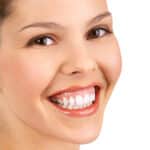 Gummy Smile Botoks