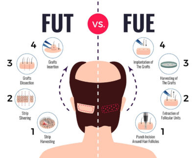 fut - fue farkı