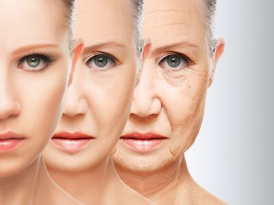 Anti-Aging