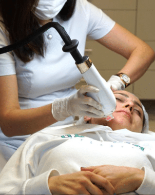 Laser Skin Resurfacing