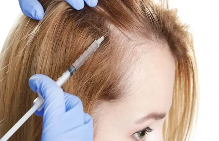 علاجات مبتكرة لتسريع نمو الشعر