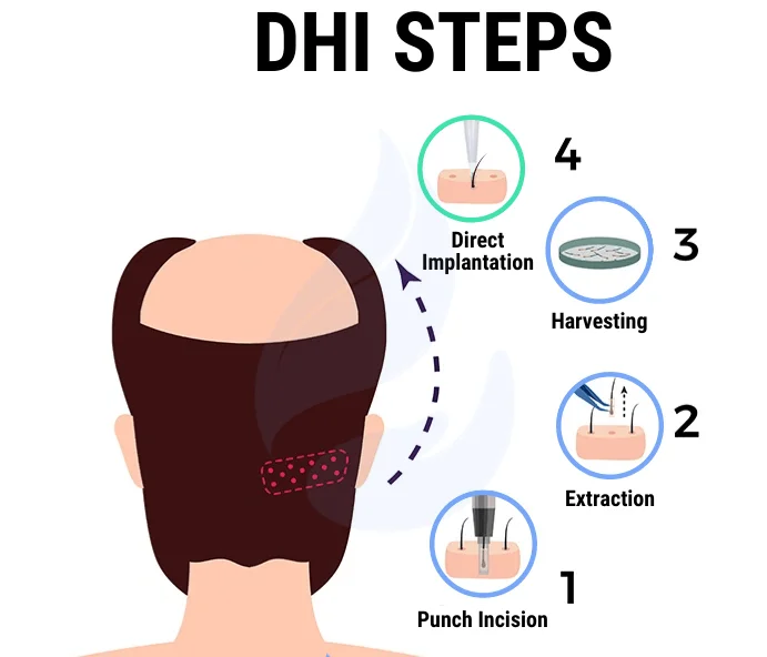 dhi sac ekim asamalari1