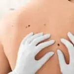 et beni