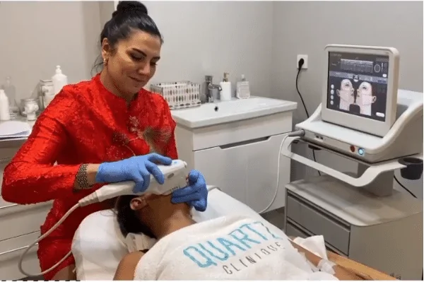 Ultherapy Ultherapy