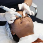 HydraFacial